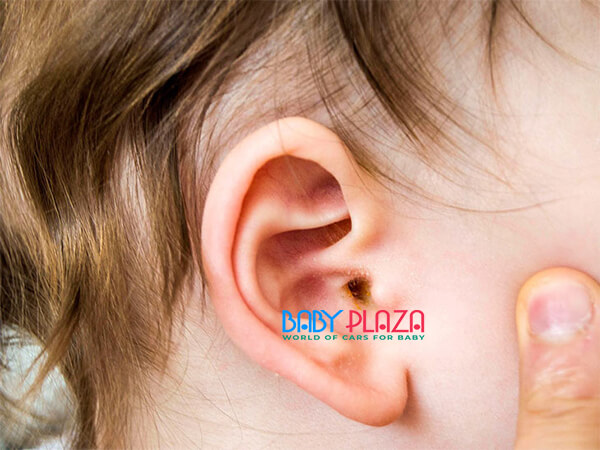 nguyên nhân gây nên bệnh viêm tai giữa ở trẻ